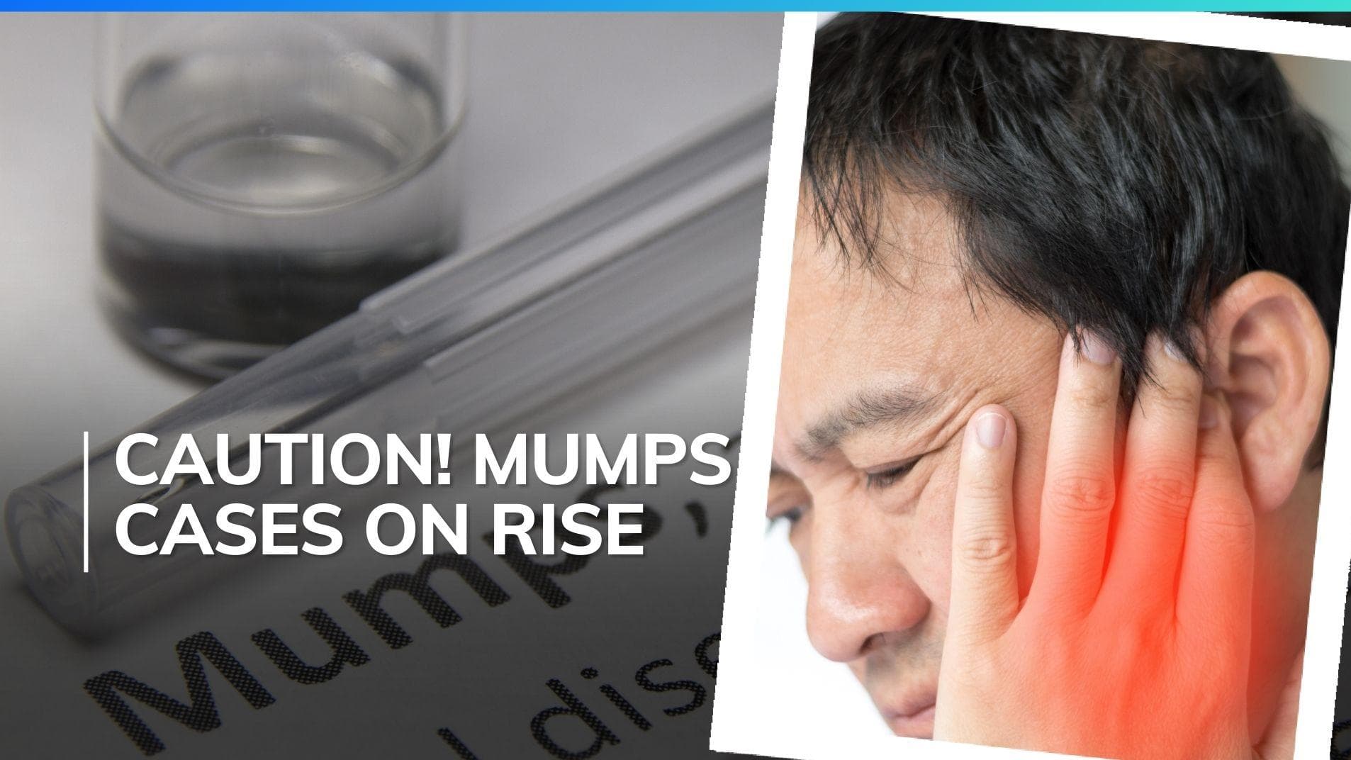 Mumps cases continue to rise in other states and Delhi-NCR, know symptoms and precautions 