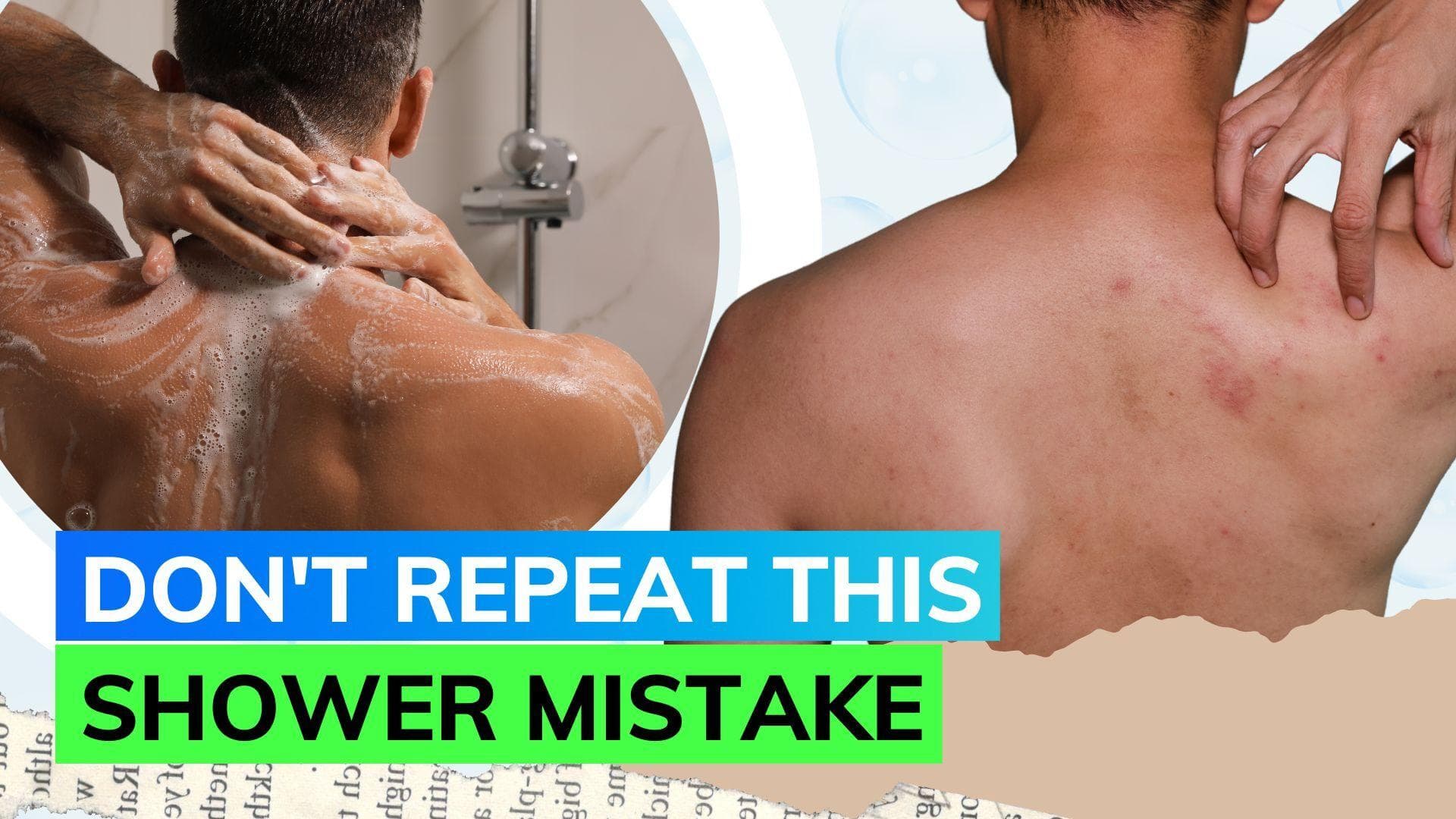 Struggling with body acne? Here's how you can treat it, according to skincare influencer 