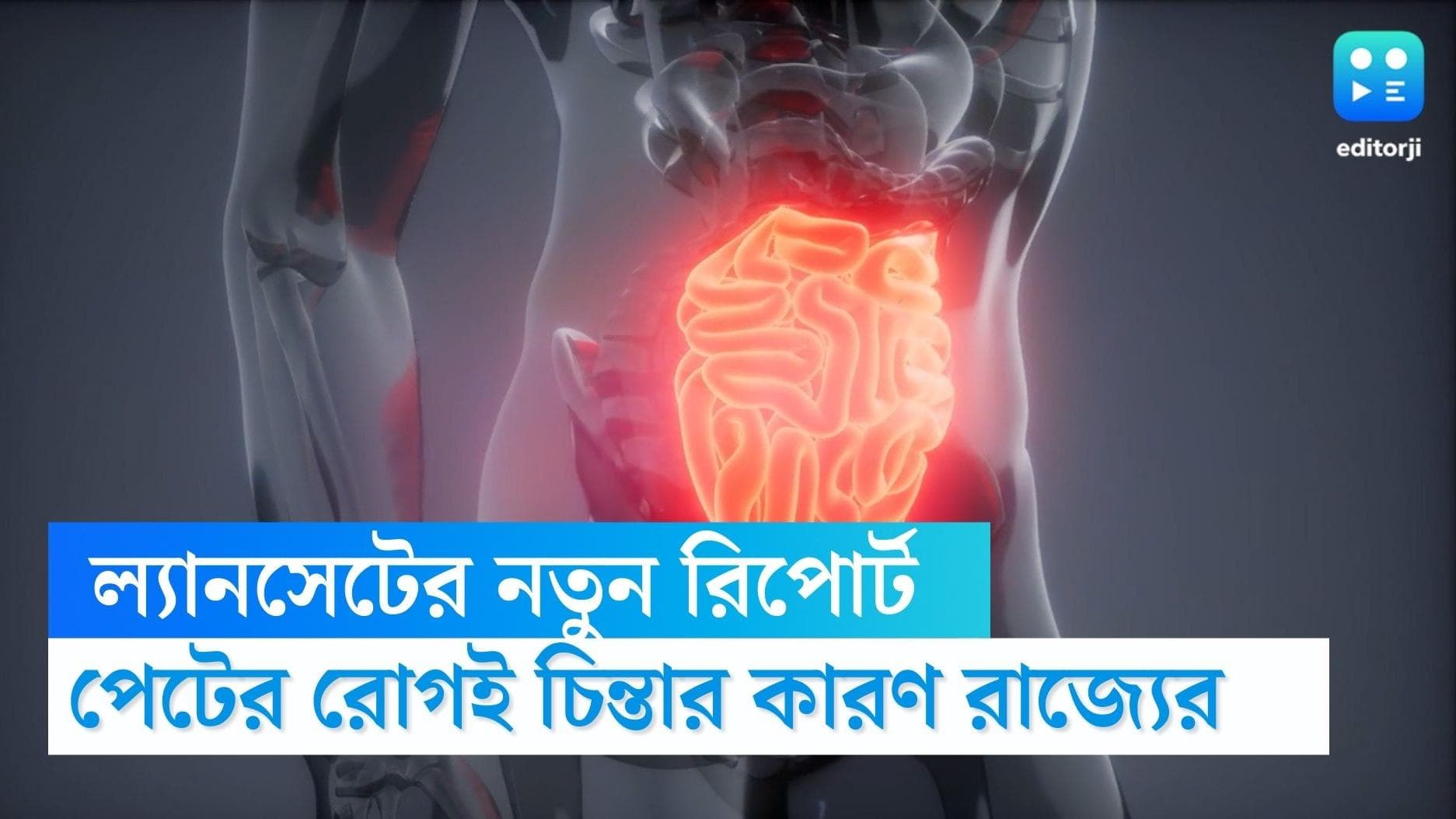 Lancet study on metabolic disease: রাজ্যে পেটের রোগের সমস্যা বাড়ছে প্রবলভাবে, জানাচ্ছে ল্যানসেটের সমীক্ষা