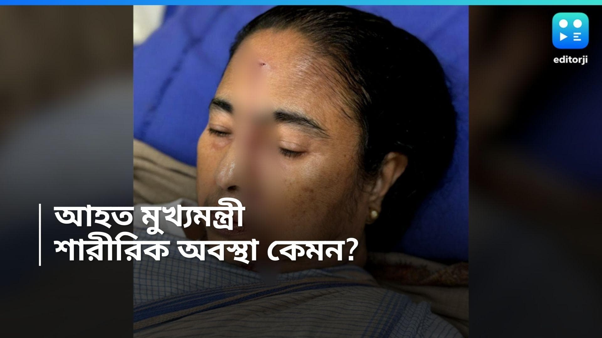 Mamata Banerjee: মুখ্যমন্ত্রী মমতা বন্দ্যোপাধ্যায়ের কপালে গভীর ক্ষত, SSKM -এ গঠিত হল মেডিকেল বোর্ড