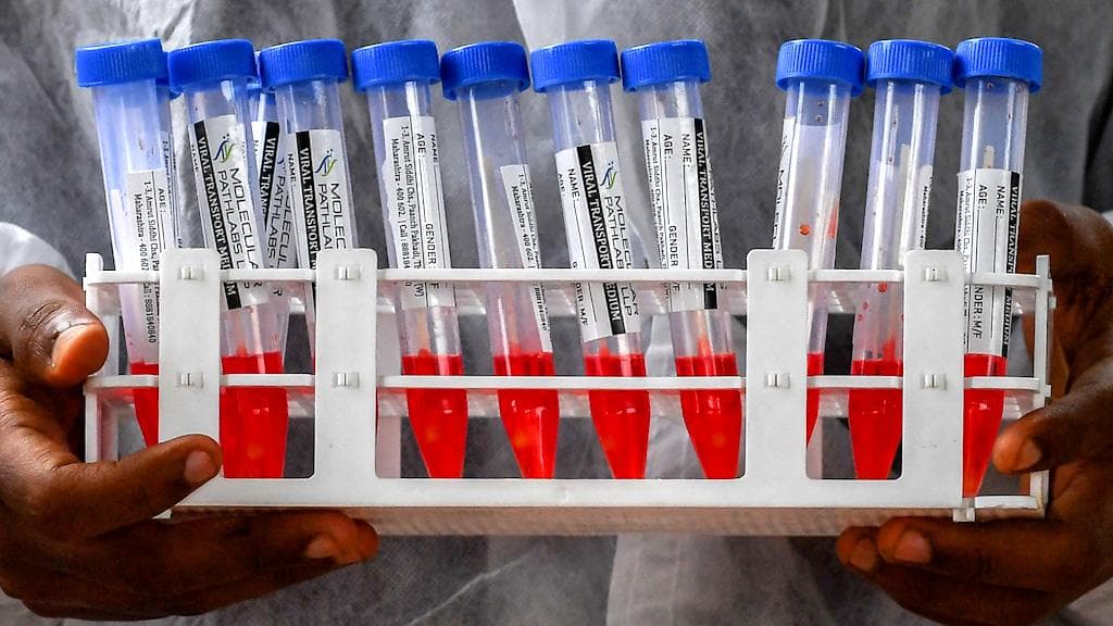 Covid in WB: কলকাতা একাই ৬ হাজার, বঙ্গে আক্রান্ত ১৪,০২২, করোনায় কাবু সাংসদ-অভিনেত্রী মিমি চক্রবর্তী