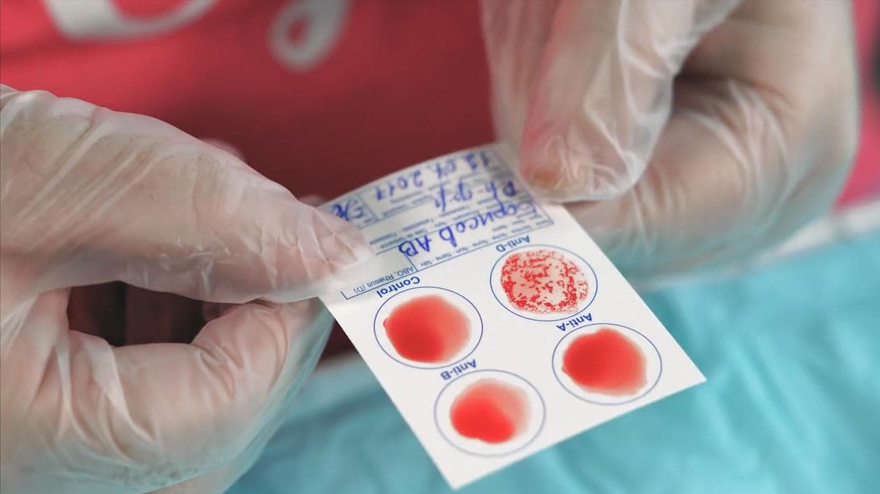 Relation b/w Blood group and covid 19: আপনার ব্লাডগ্রুপ কী? জানেন, করোনা আক্রান্ত হওয়ার ঝুঁকি কতোটা?