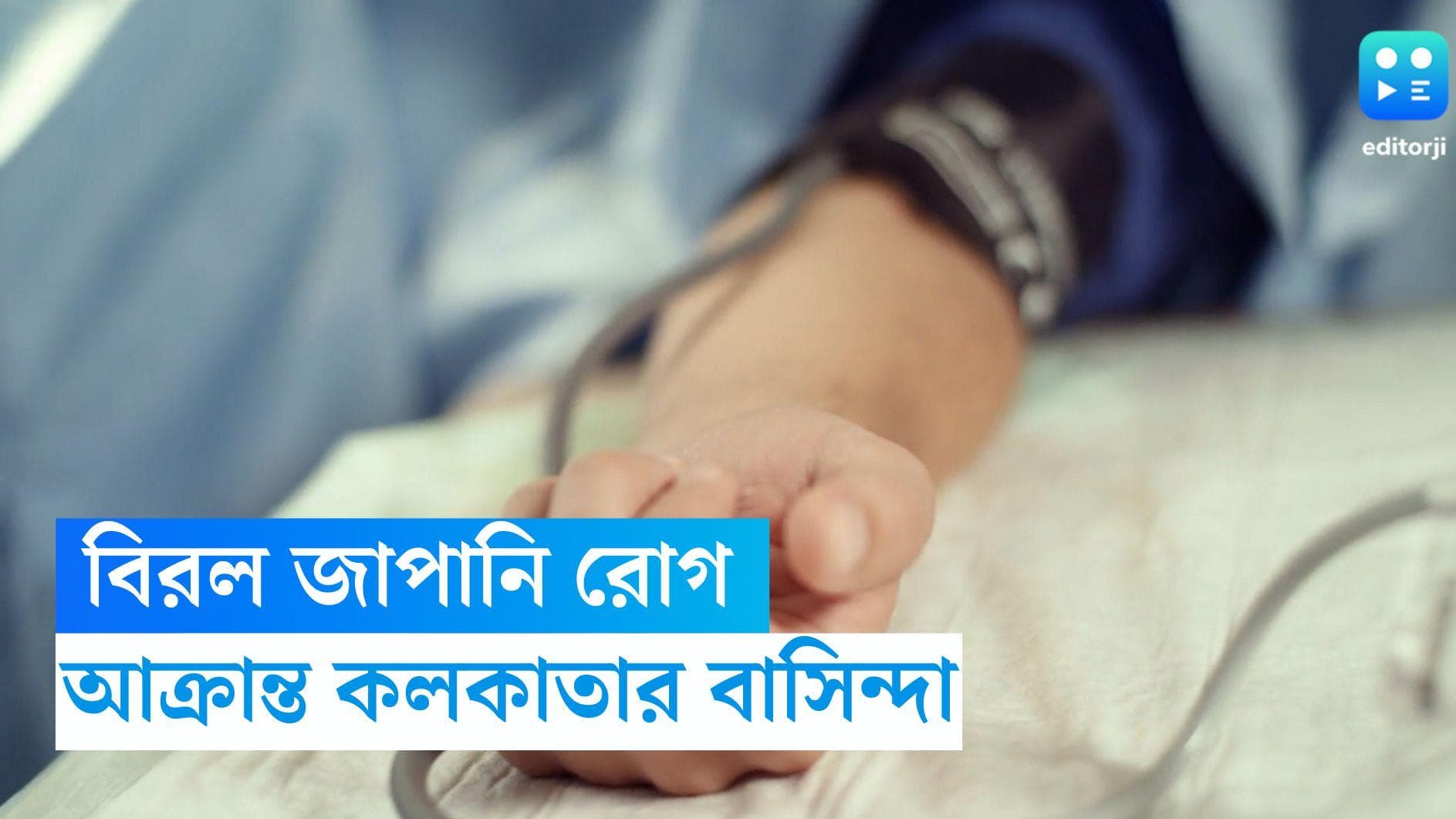 Calcutta Medical College: বিরল জাপানি রোগে আক্রান্ত কলকাতার বাসিন্দা