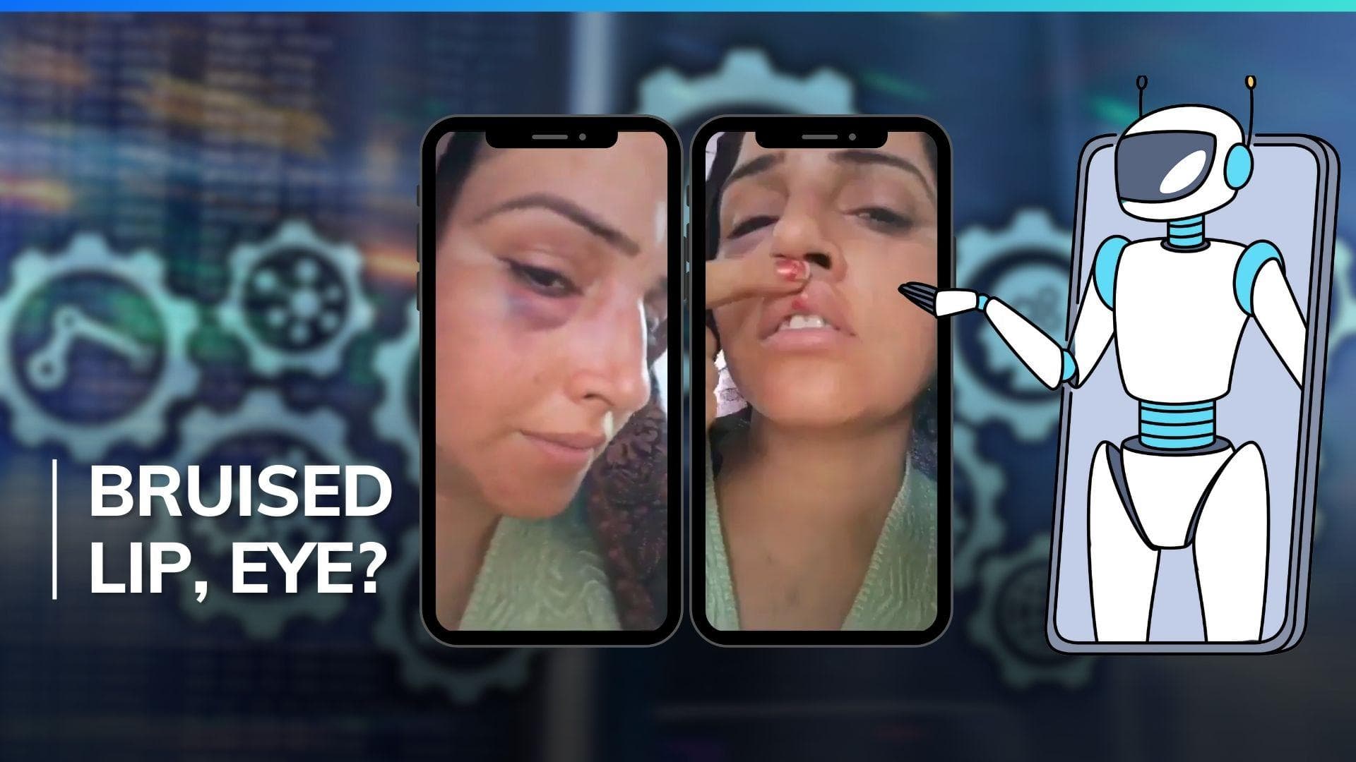 Viral video of Seema Haider's injuries puts spotlight on AI dangers