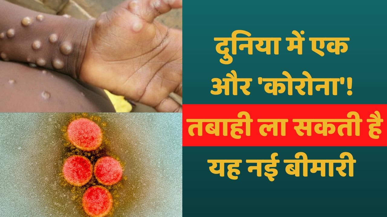 Monkeypox: सावधान...! दुनिया में आई एक और जानलेवा बीमारी, भारत ने सील किए बॉर्डर