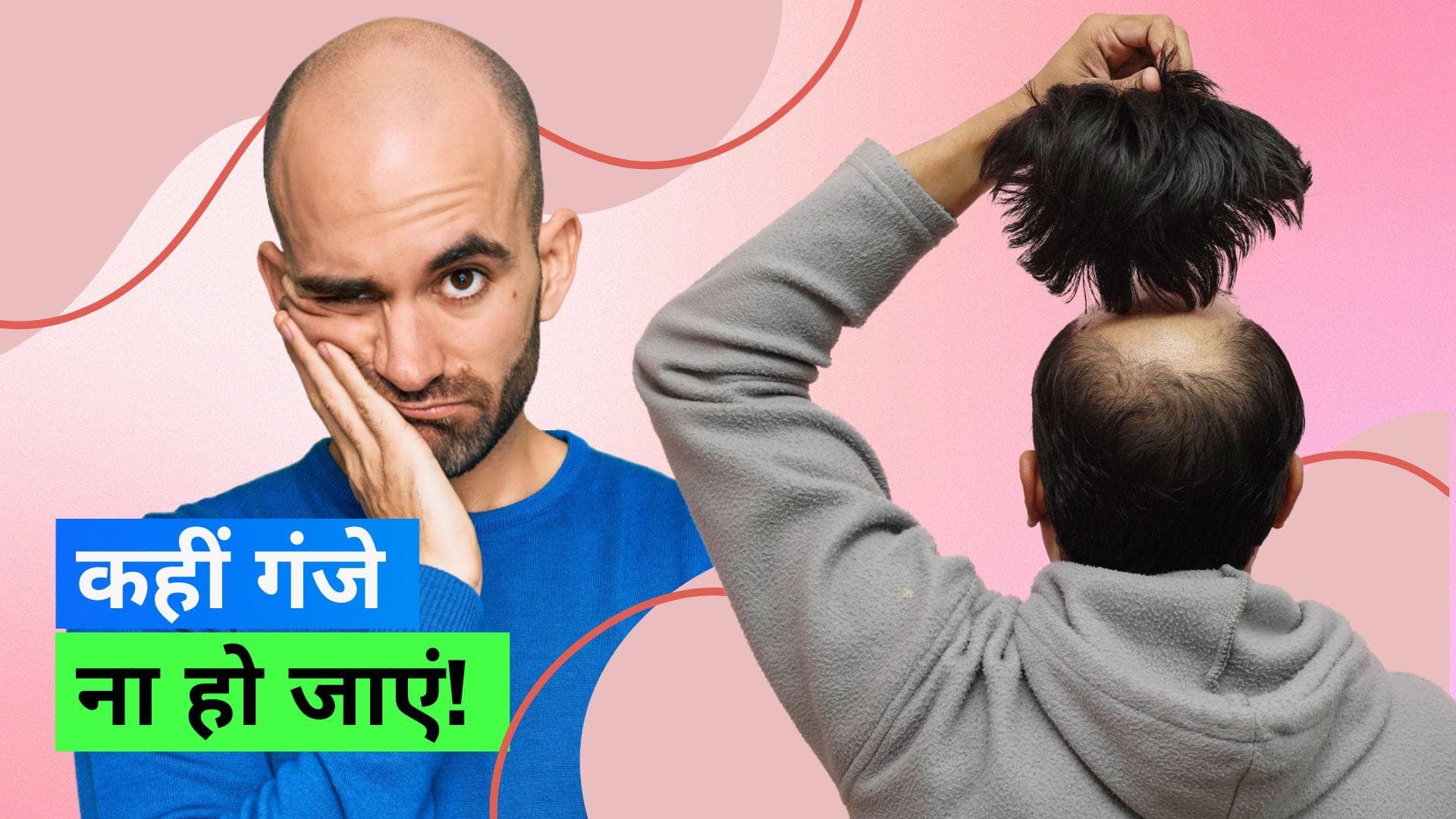 Baldness in Men: उम्र से पहले ही लड़के क्यों हो जाते हैं गंजे? बचने के लिए आज से ही फॉलो करें ये टिप्स