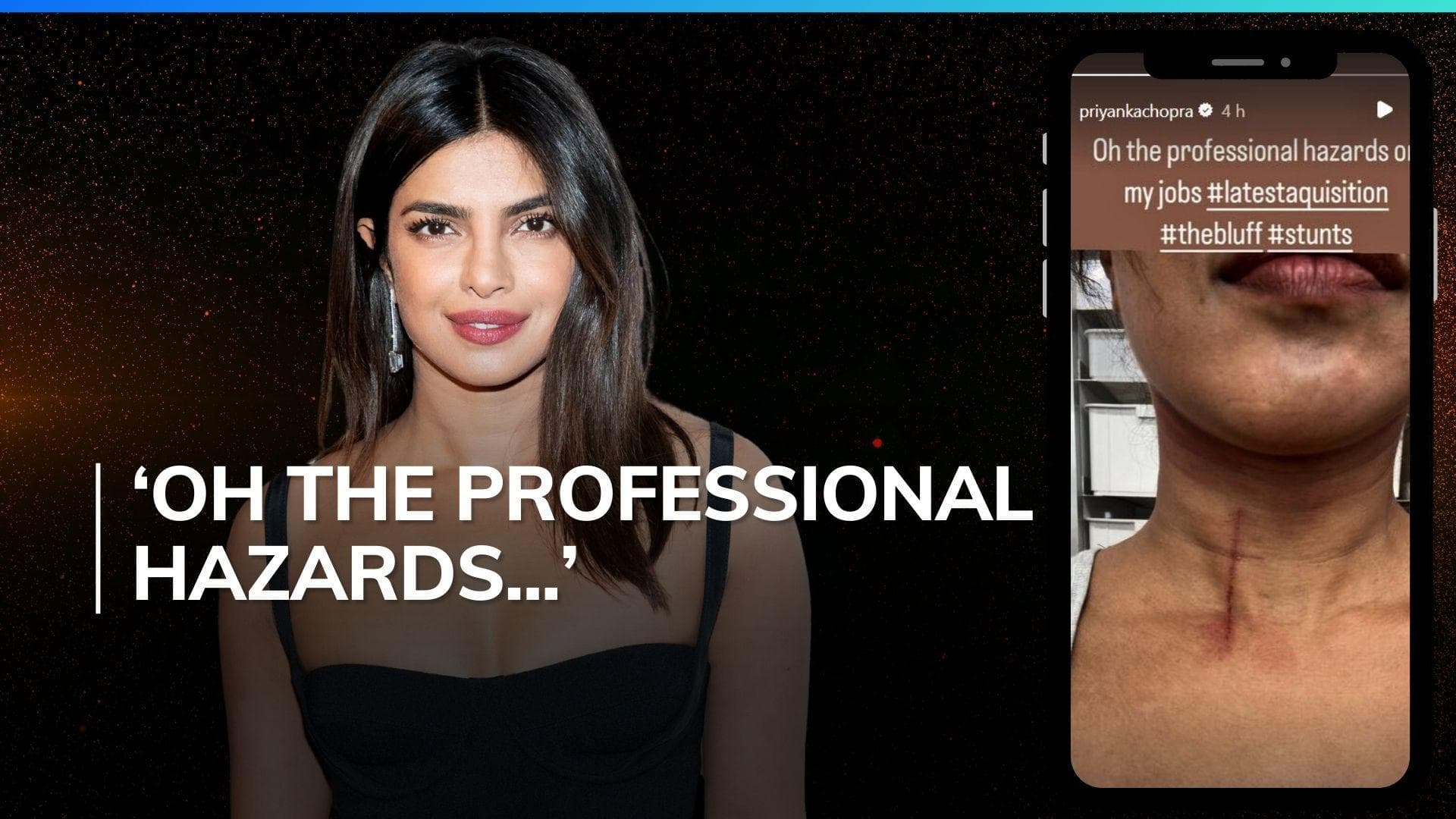 ‘The Bluff’: Priyanka Chopra gets injured while filming stunt scenes; shares pic