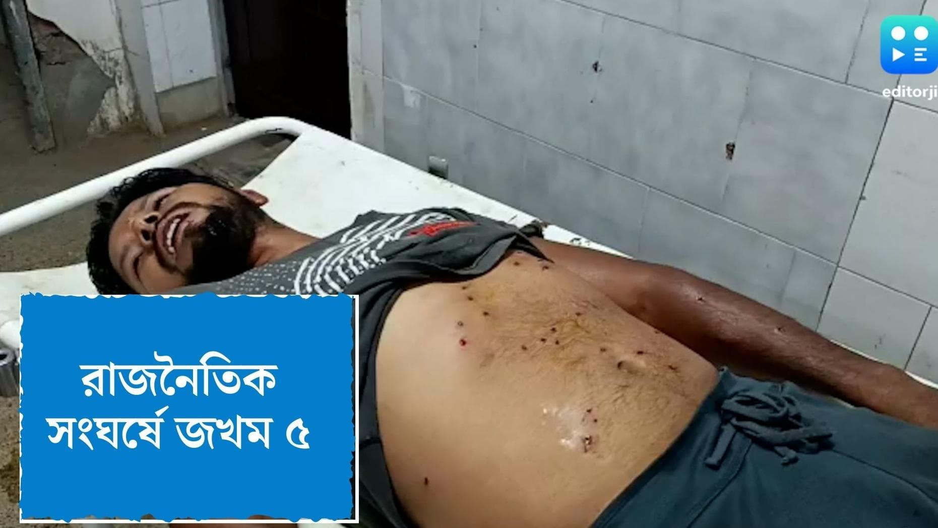 Islampur Clash: ইসলামপুরে চা বাগানের জমিকে কেন্দ্র করে বিবাদ, রাজনৈতিক সংঘর্ষ, গুলি, জখম পাঁচ