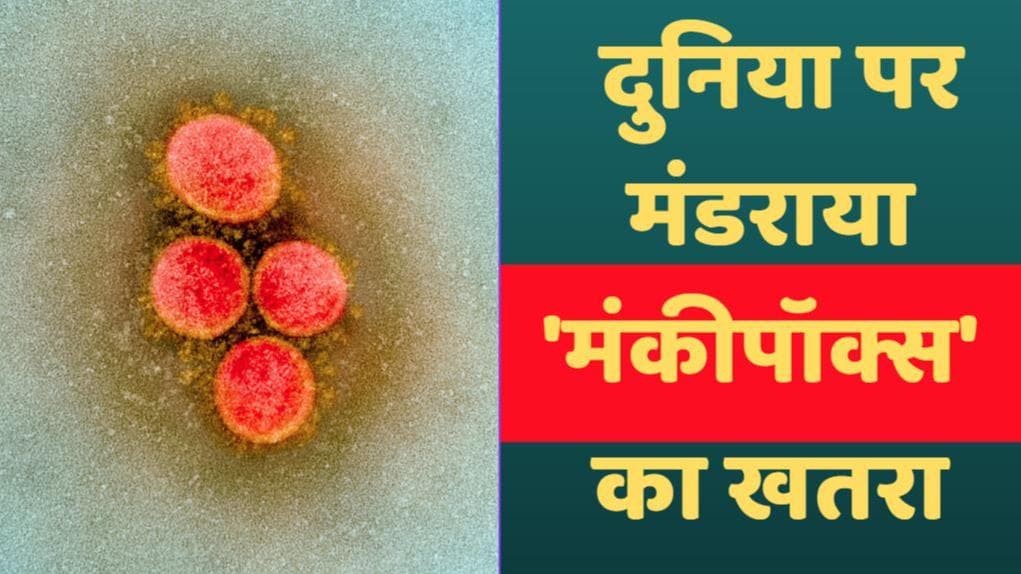 Monkeypox Virus: कोरोना के बीच दुनिया में मंकीपॉक्स का कहर...ब्रिटेन के बाद US में मिला पहला केस
