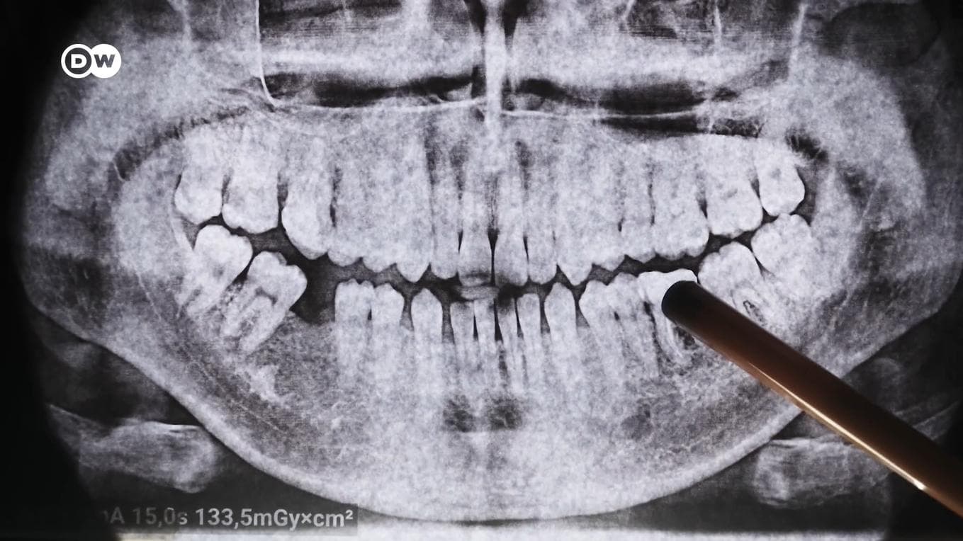 Why don't teeth grow back?