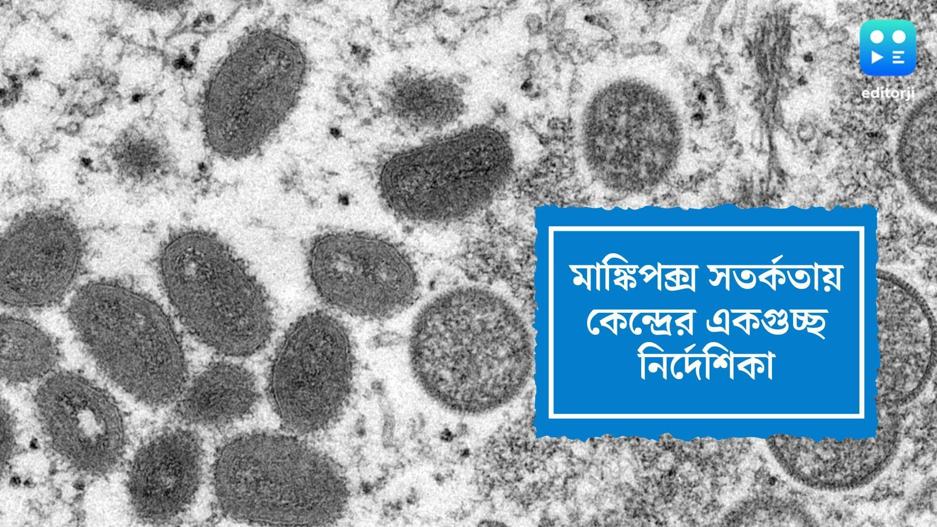Central Guidelines on Monkeypox: মাঙ্কিপক্স সতর্কতায় একগুচ্ছ নির্দেশিকা কেন্দ্রের, তালিকায় ক্রিম, লোশন