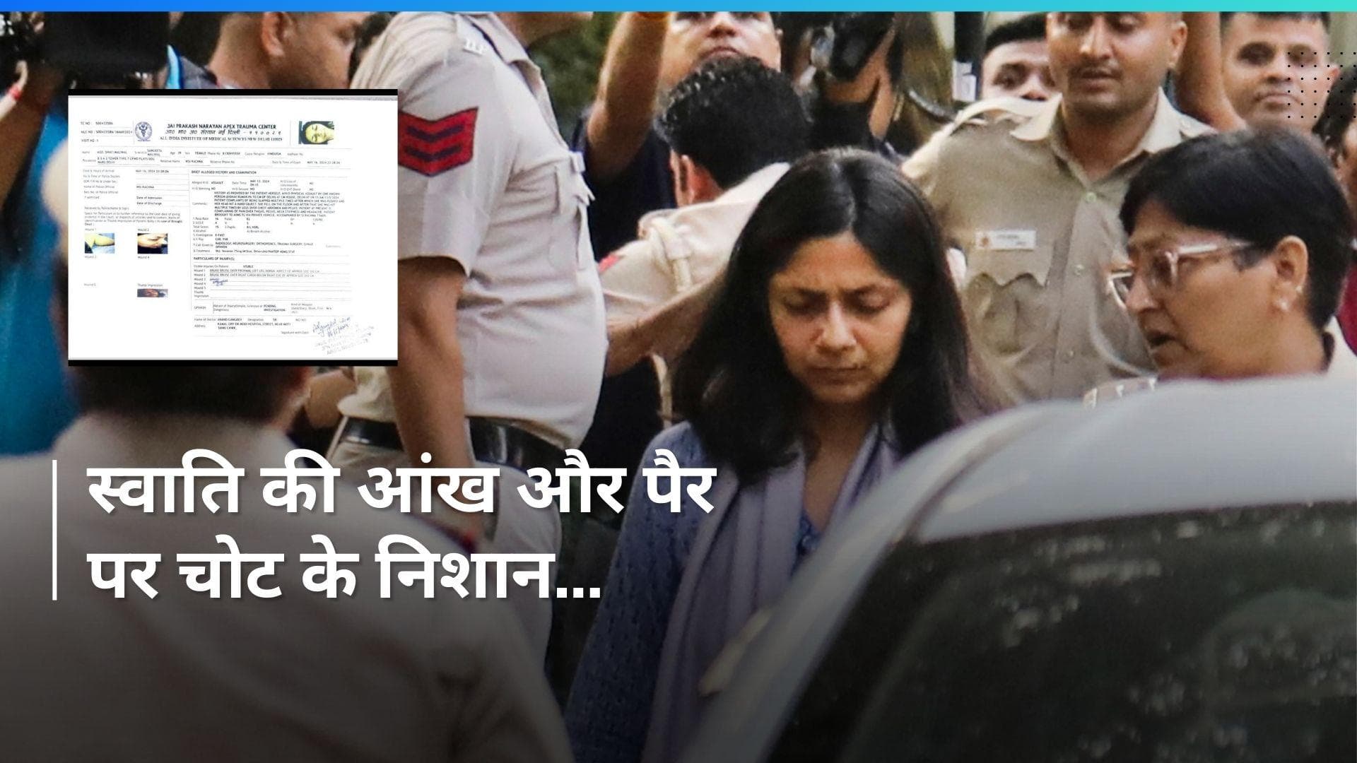 Swati Maliwal को कहां-कहां लगी है चोट...? मेडिकल रिपोर्ट में हुआ खुलासा