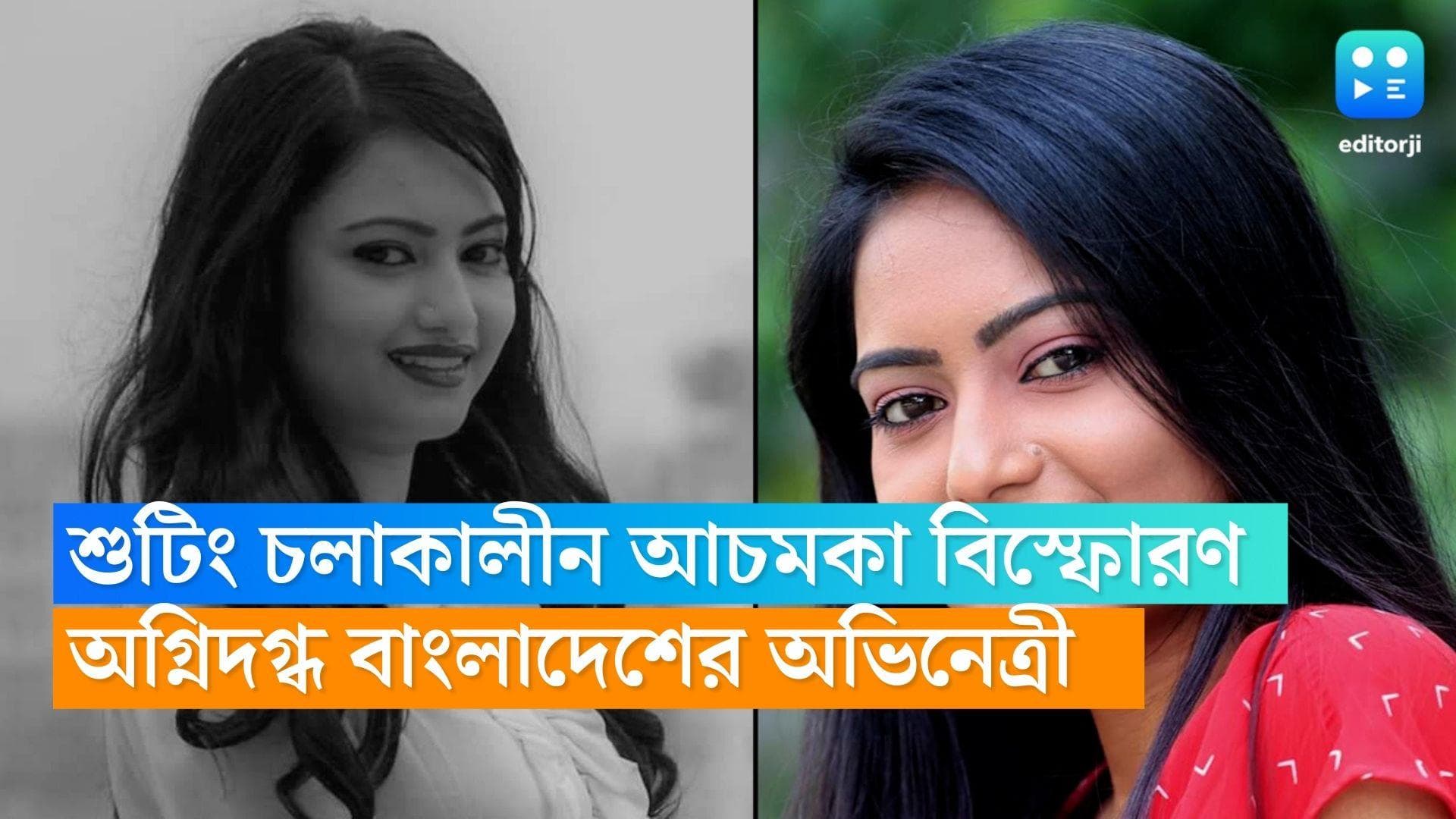 Sharmeen Akhee : শুটিং চলাকালীন আচমকা বিস্ফোরণ! গুরুতর জখম বাংলাদেশের অভিনেত্রী শারমিন,ঝলসে গিয়েছে মুখ,পা