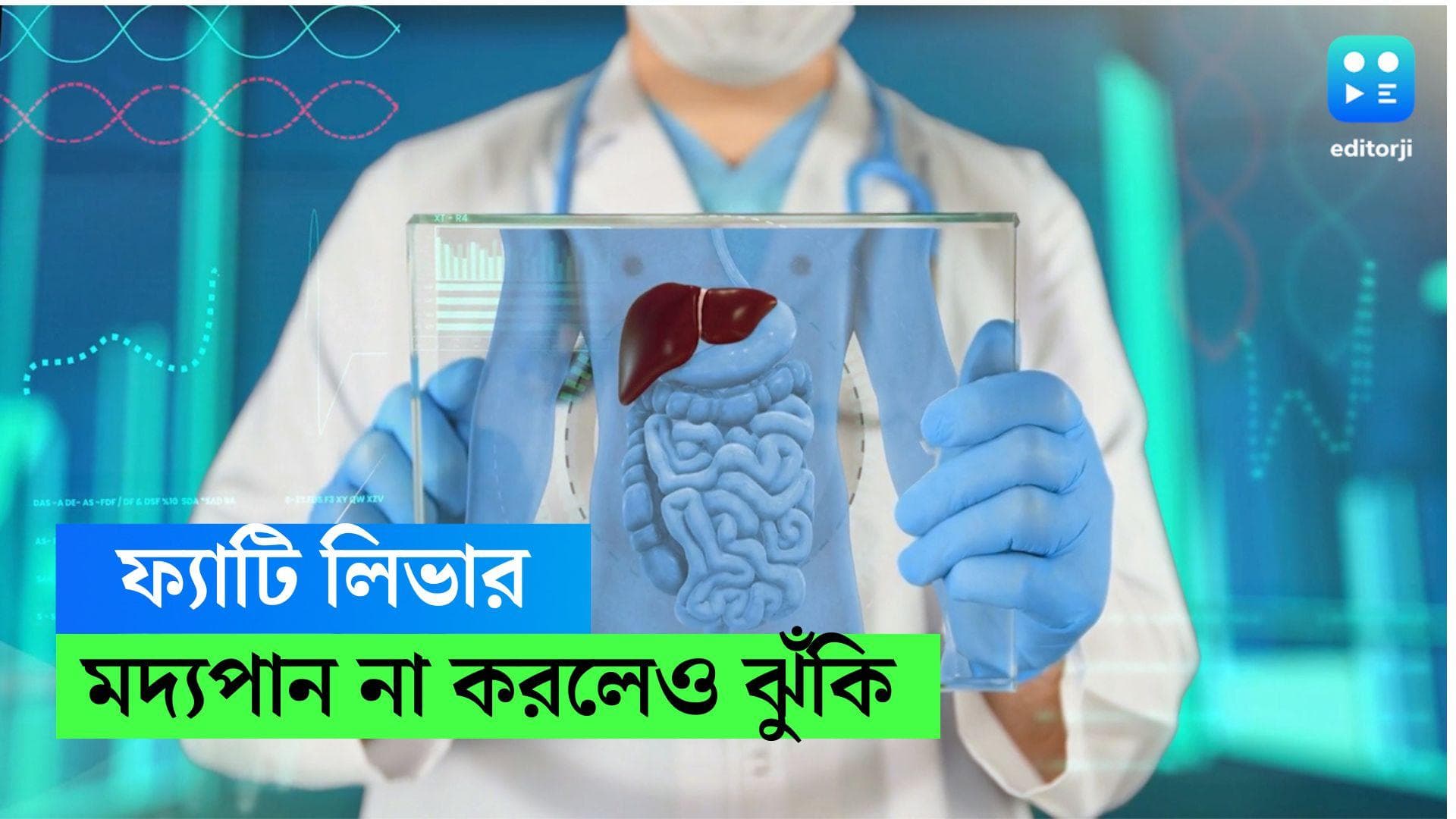 NAFLD: মদ্যপান না করলেও থাকছে ফ্যাটি লিভারের ঝুঁকি! রিপোর্ট প্রকাশ এইমসের 