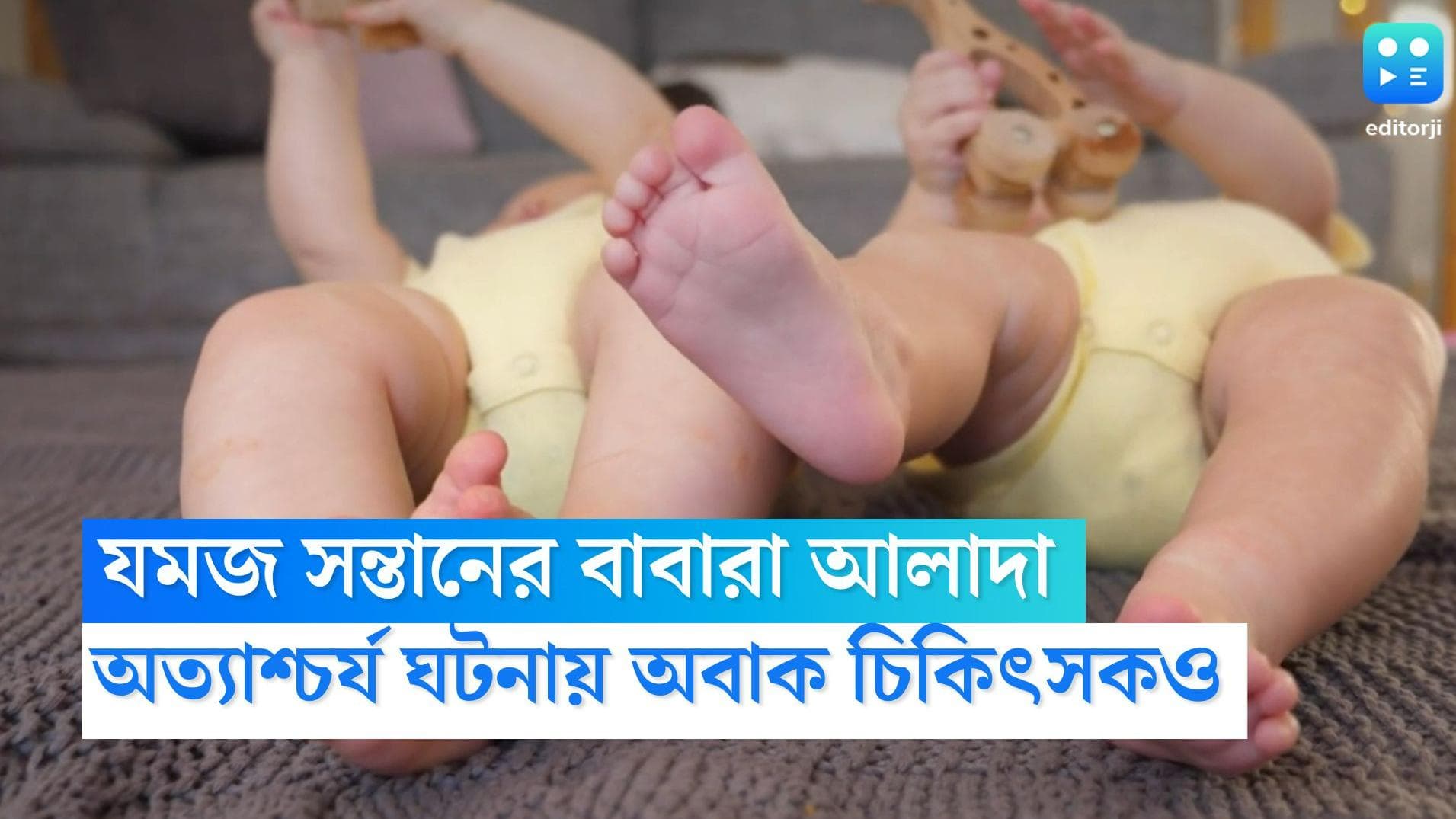 Twins from different fathers: মায়ের গর্ভে যমজ সন্তানের বাবারা আলাদা, অত্যাশ্চর্য ঘটনায় অবাক চিকিৎসকও