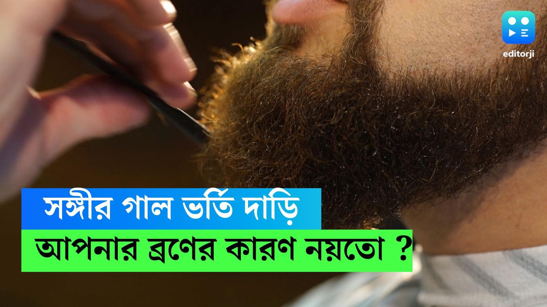 Partner's Beard- Acne: সঙ্গীর এক গাল দাড়ি আছে? আপনার ত্বকে দেখা দিতে পারে ব্রণ