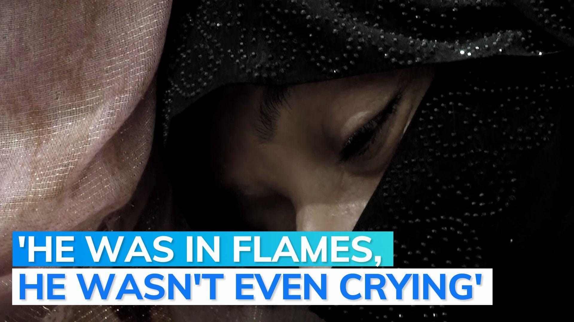 Mother of Pakistani boy who was set ablaze by father recalls horror