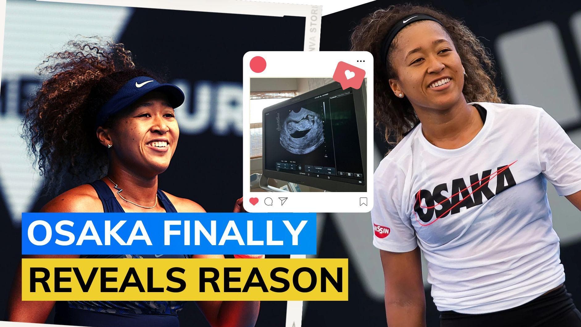 Naomi Osaka announces pregnancy, plans Tennis return in 2024