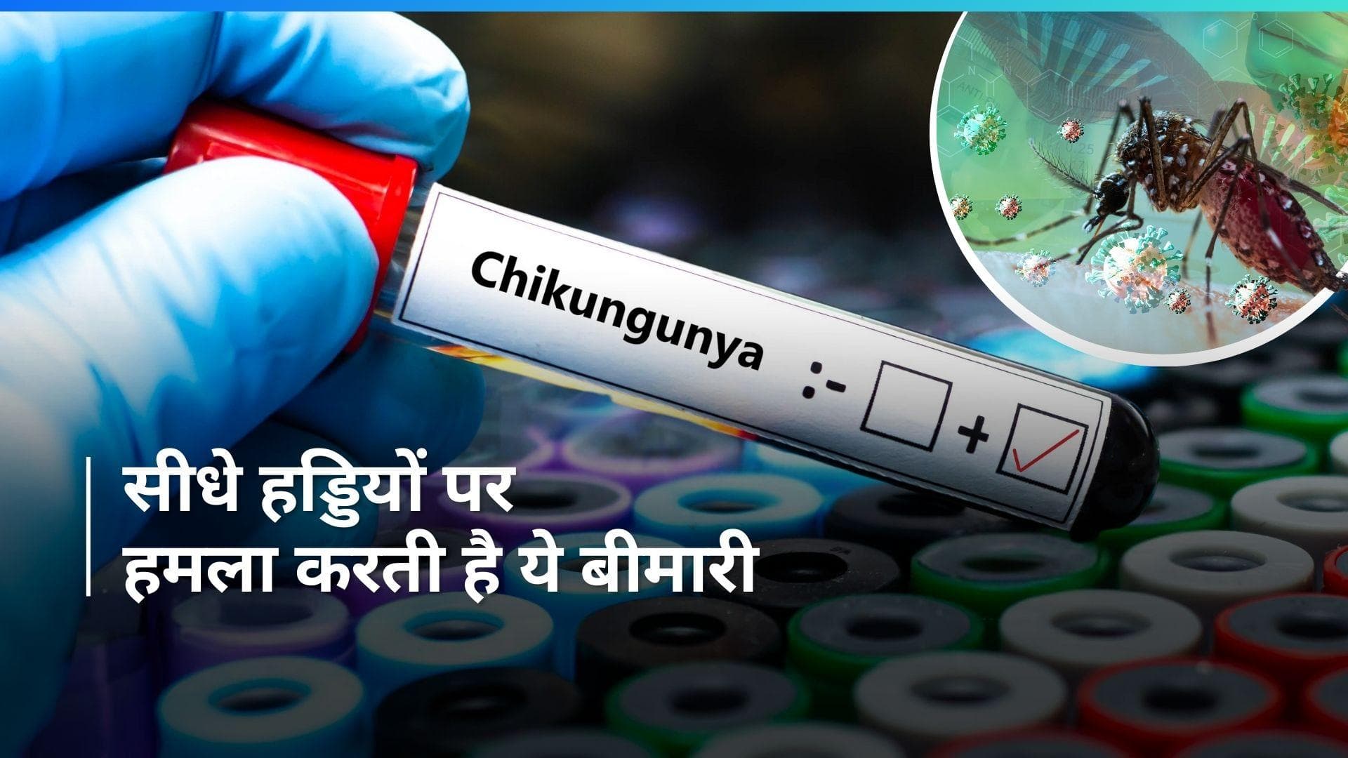 Chikungunya: चिकनगुनिया होने के 3 महीने तक रहता है मौत का खतरा, लैंसेट स्टडी में हुआ खुलासा