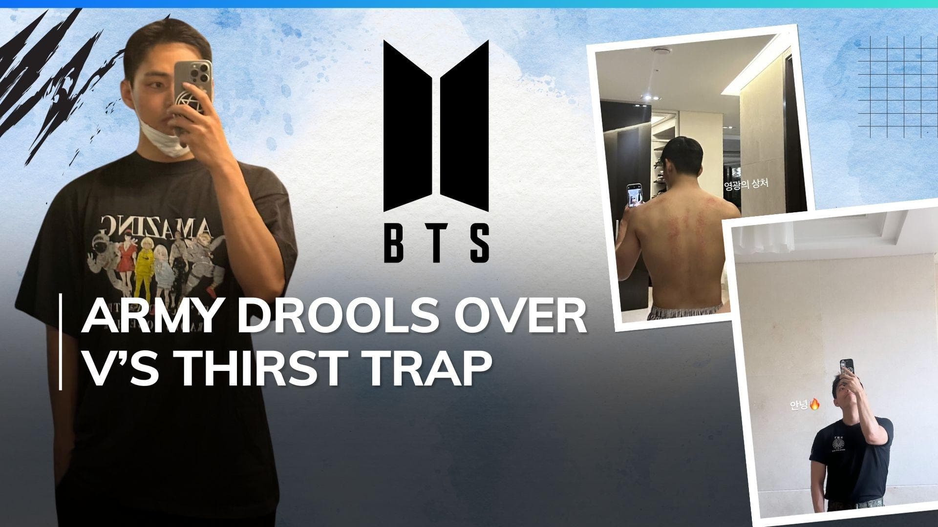 Kim Taehyung aka V of BTS flaunts ‘wounds of glory’, shares his latest pictures on Instagram