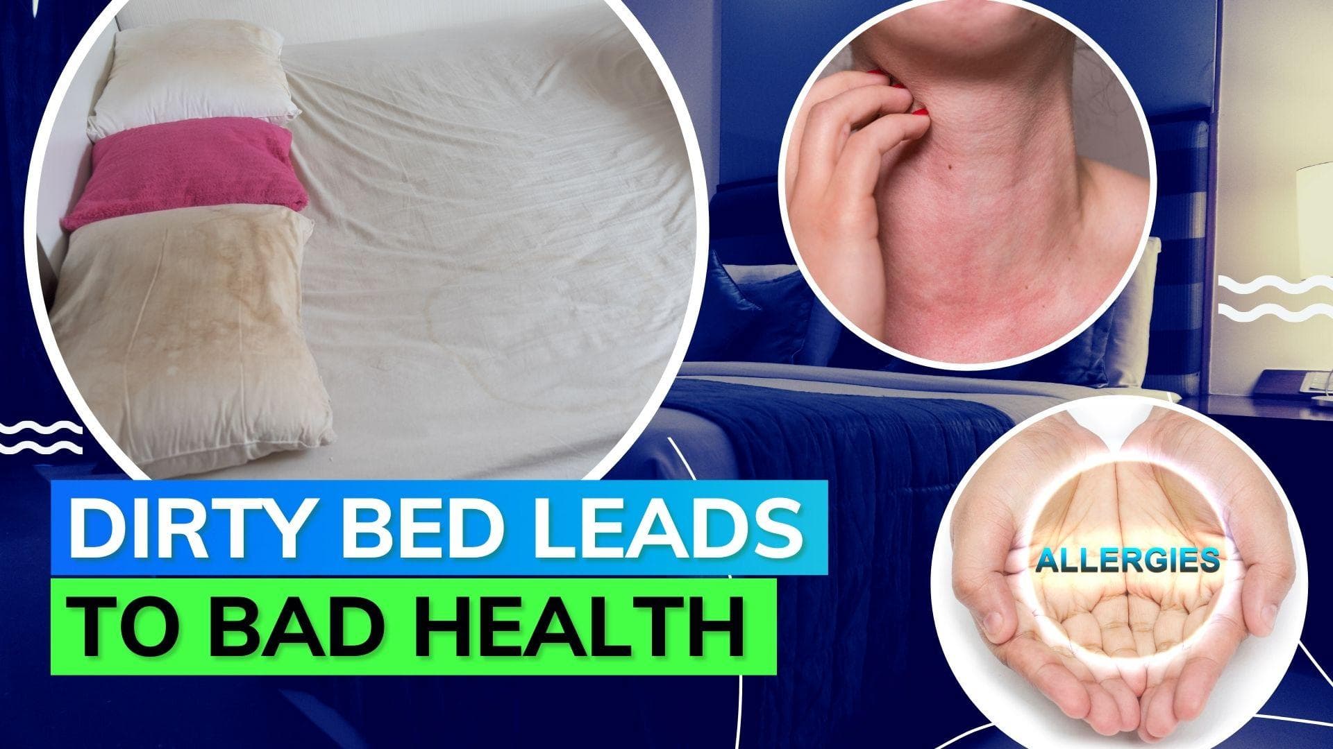 Know how dirty bed sheets can cause severe health issues
