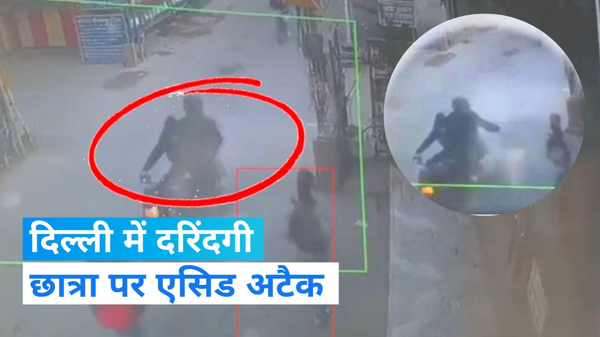 Acid Attack: दिल्ली में नाबालिग लड़की पर सरेआम फेंका एसिड, CCTV में कैद हुई वारदात