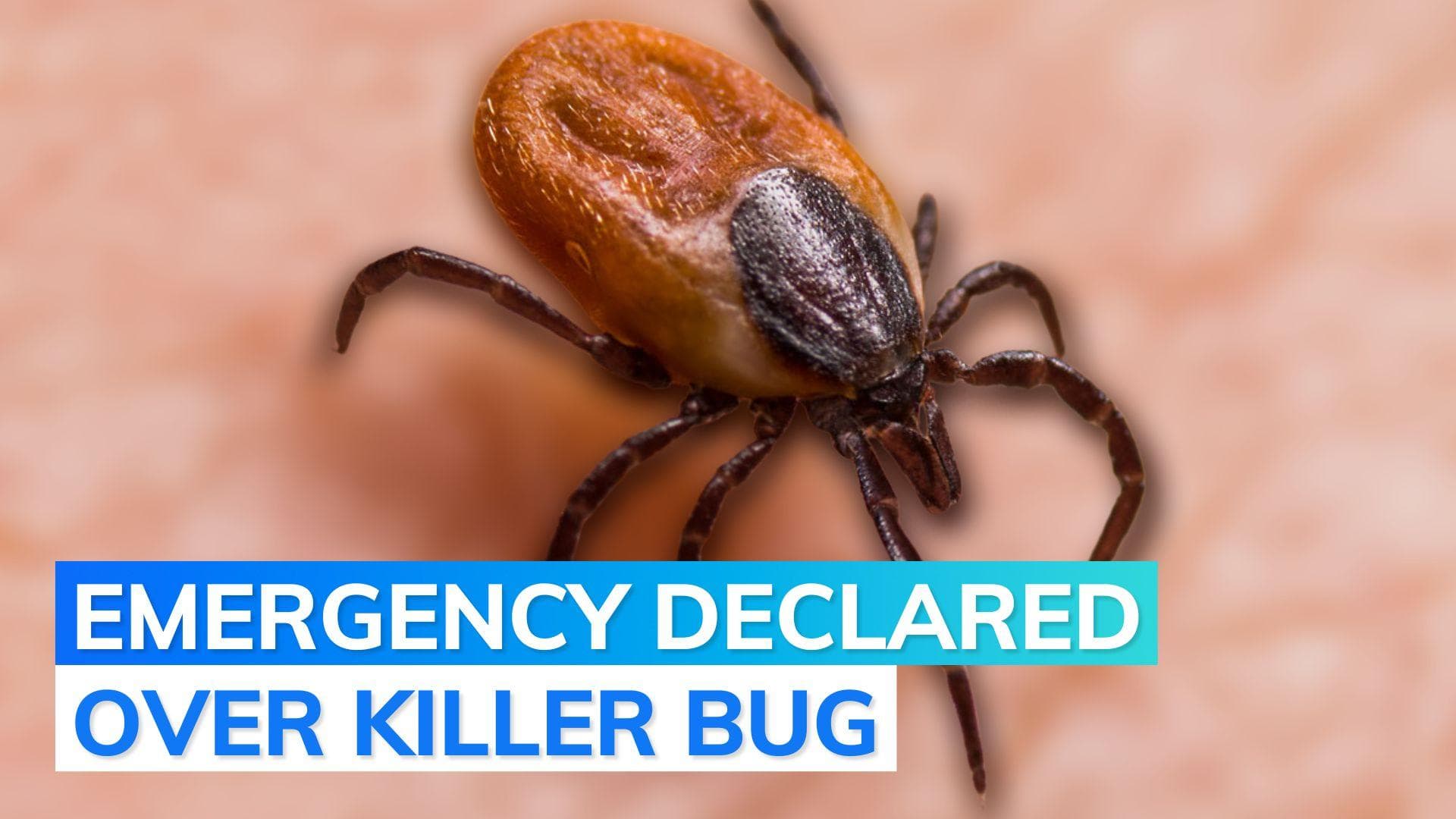 Namibia reports death from tick-virus that makes people bleed from eyes