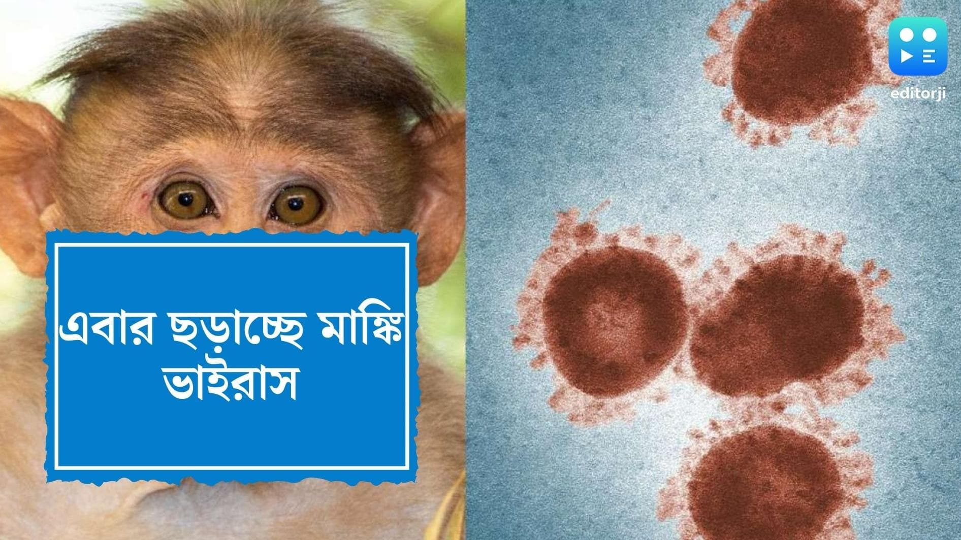 Monkey virus:যৌন সংসর্গেও ছড়াতে পারে মাঙ্কি ভাইরাস, সতর্ক করলেন বিশেষজ্ঞরা
