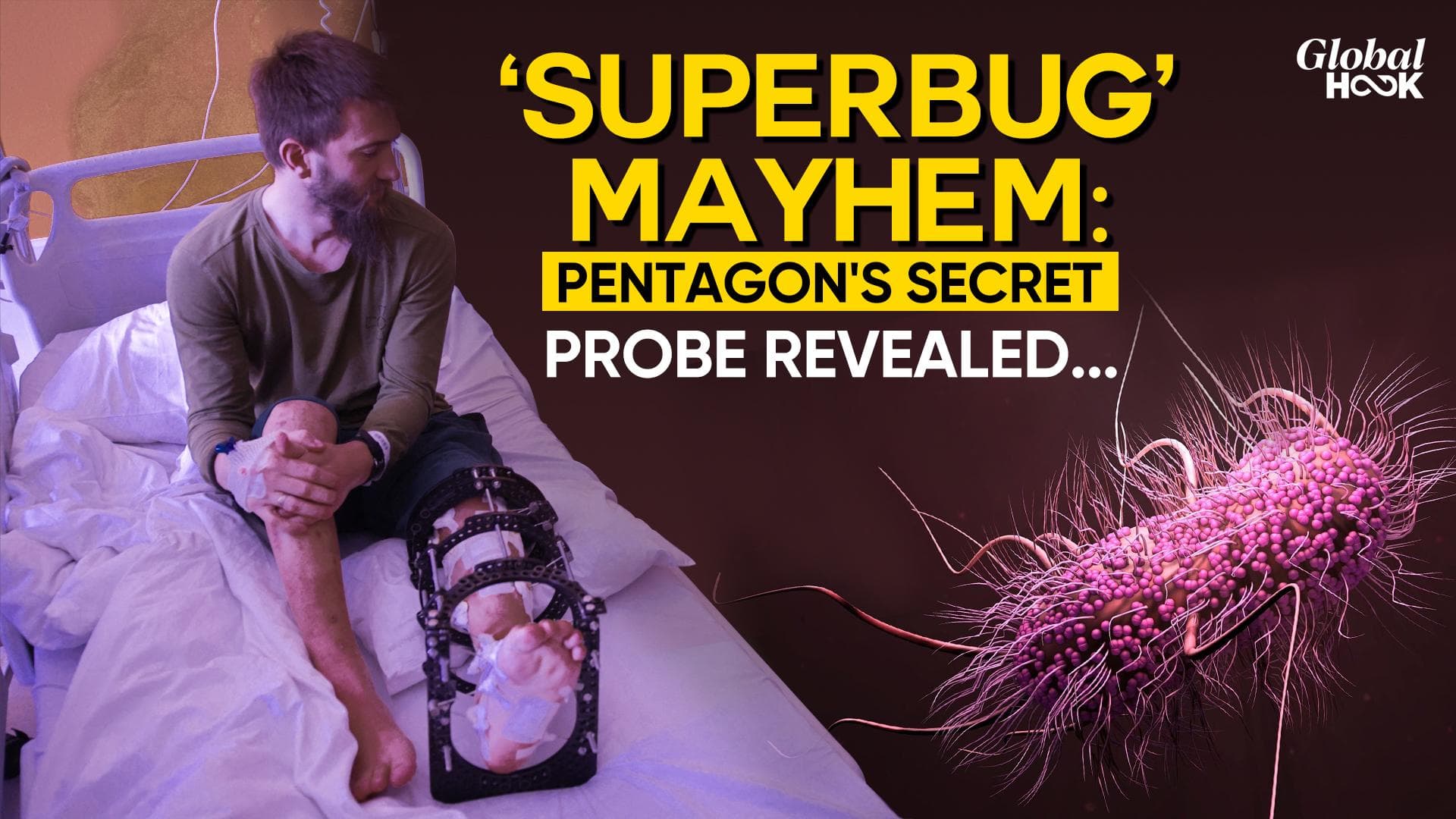 Plague Or Preparation? Superbug Hits Ukraine Forces, European Doctors Clueless