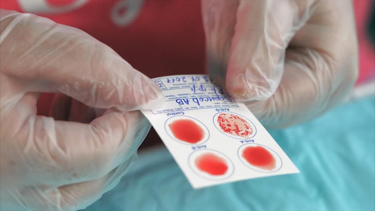 These blood groups are more prone to catching Covid, says new study