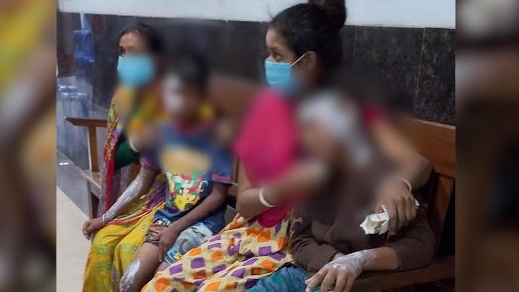 Bidhannagar Blast: নয়াপট্টি এলাকায় বিস্ফোরণে আহত ২ শিশু, পুরভোটের আগে চাঞ্চল্য এলাকায়