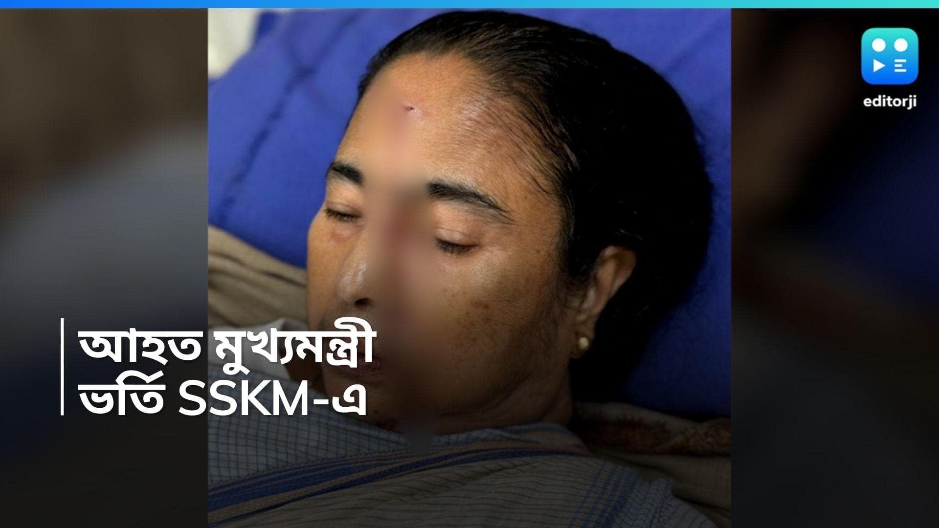 Mamata Banerjee:  গুরুতর আহত মমতা বন্দ্যোপাধ্যায়, ভর্তি SSKM হাসপাতালে