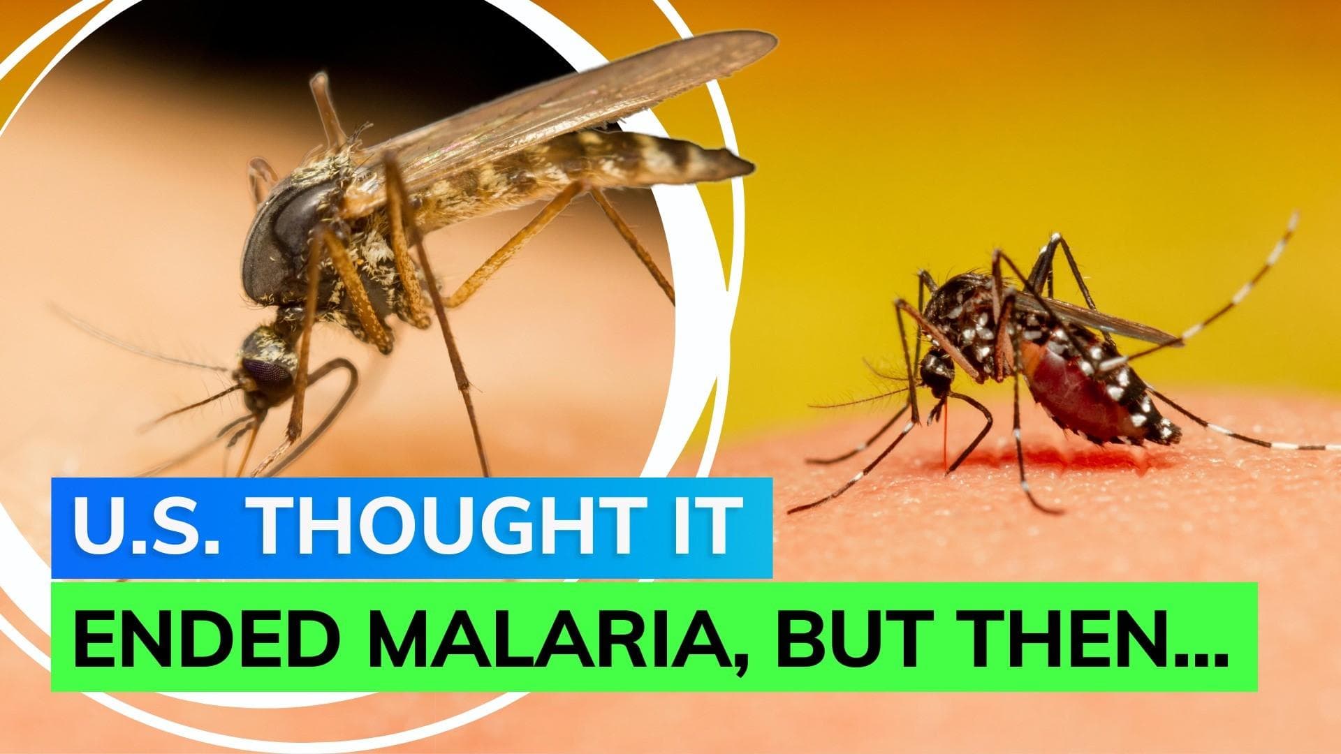 Malaria cases in USA: After 2 decades, Florida and Texas report outbreaks