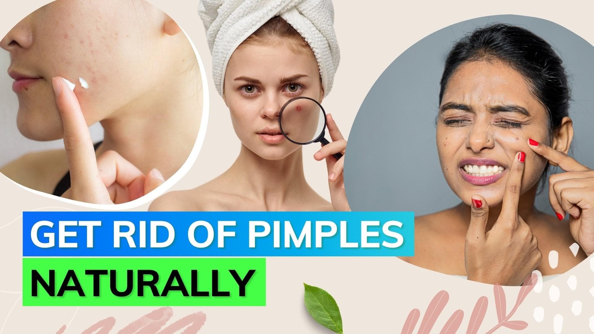 Now don't cancel your plan cause of pimples; get rid of them overnight