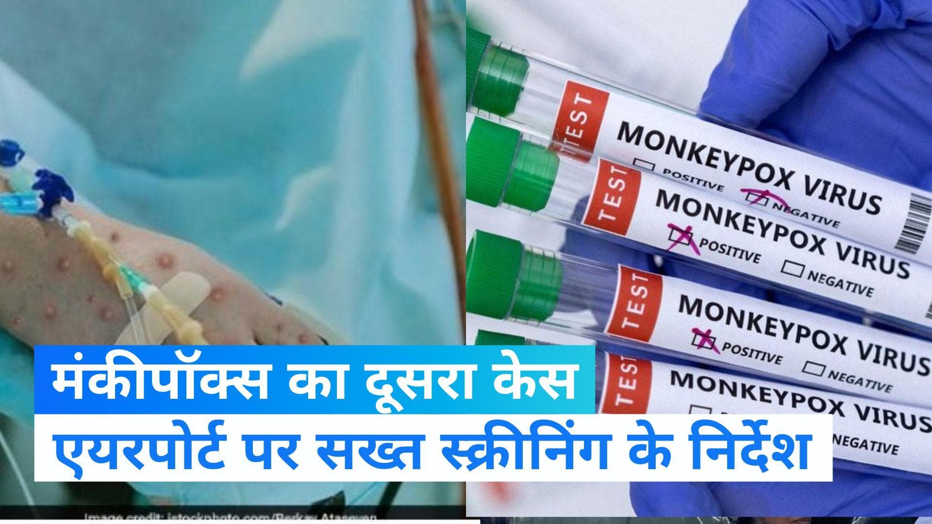 Monkeypox In India: केरल में मिला मंकीपॉक्स का दूसरा केस, एयरपोर्ट और बंदरगाहों पर स्क्रीनिंग के निर्देश